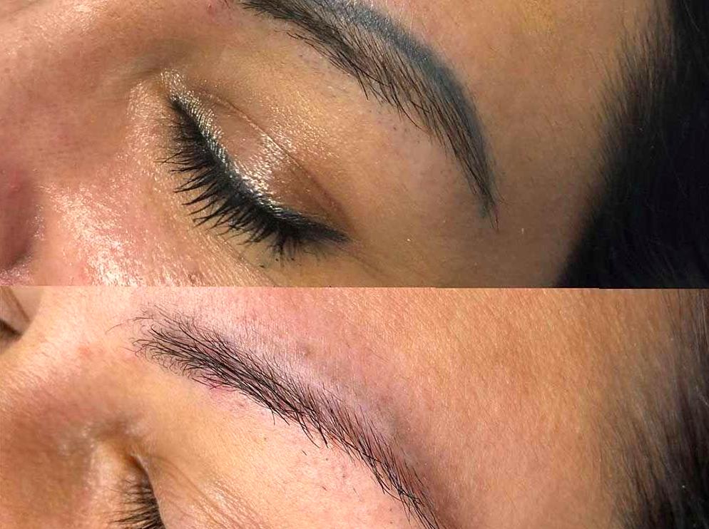 Transform Your Brows: Microblading Before and After Comparisons